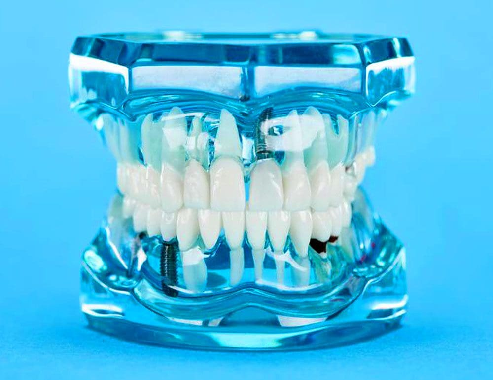 titan dental header image - JLB, Best Web Design and Web Development Company in Nashville, Brentwood, and Franklin